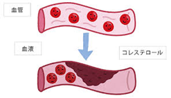 血管のイラスト