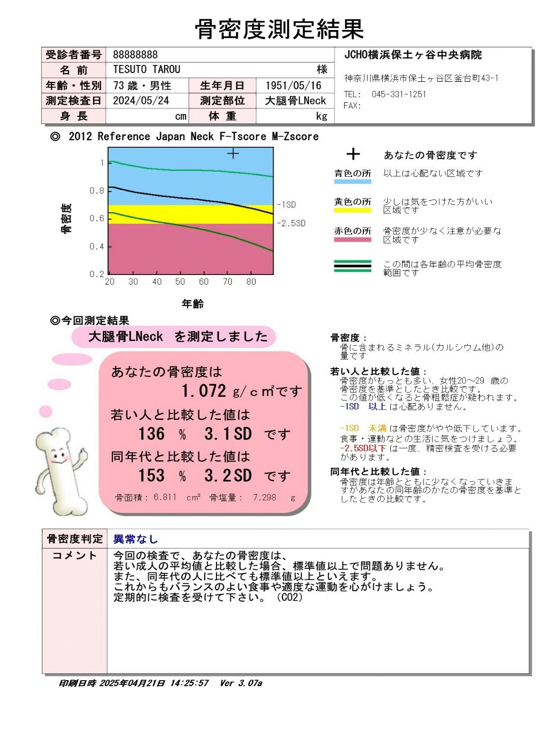 CT検査心臓